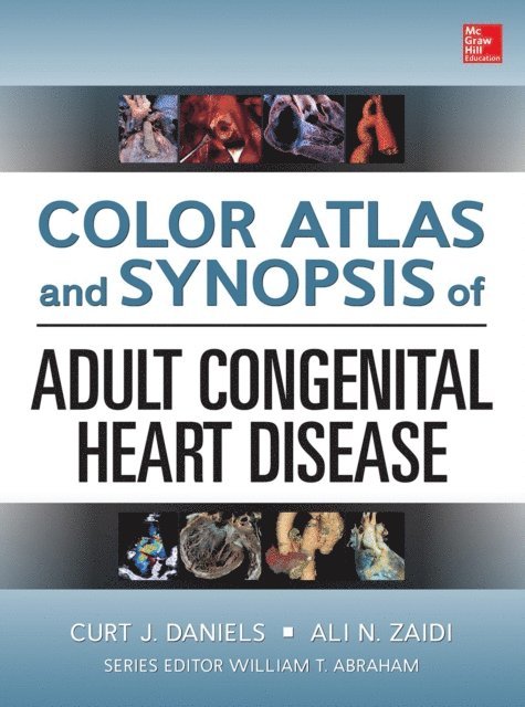 Ali N. Zaidi, Curt Daniels - Color Atlas and Synopsis of Adult Congenital Heart Disease, E-bok