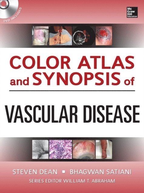 Bhagwan Satiani, Steven Dean - Color Atlas and Synopsis of Vascular Disease, E-bok. Tillgänglighet: Lägg i varukorg