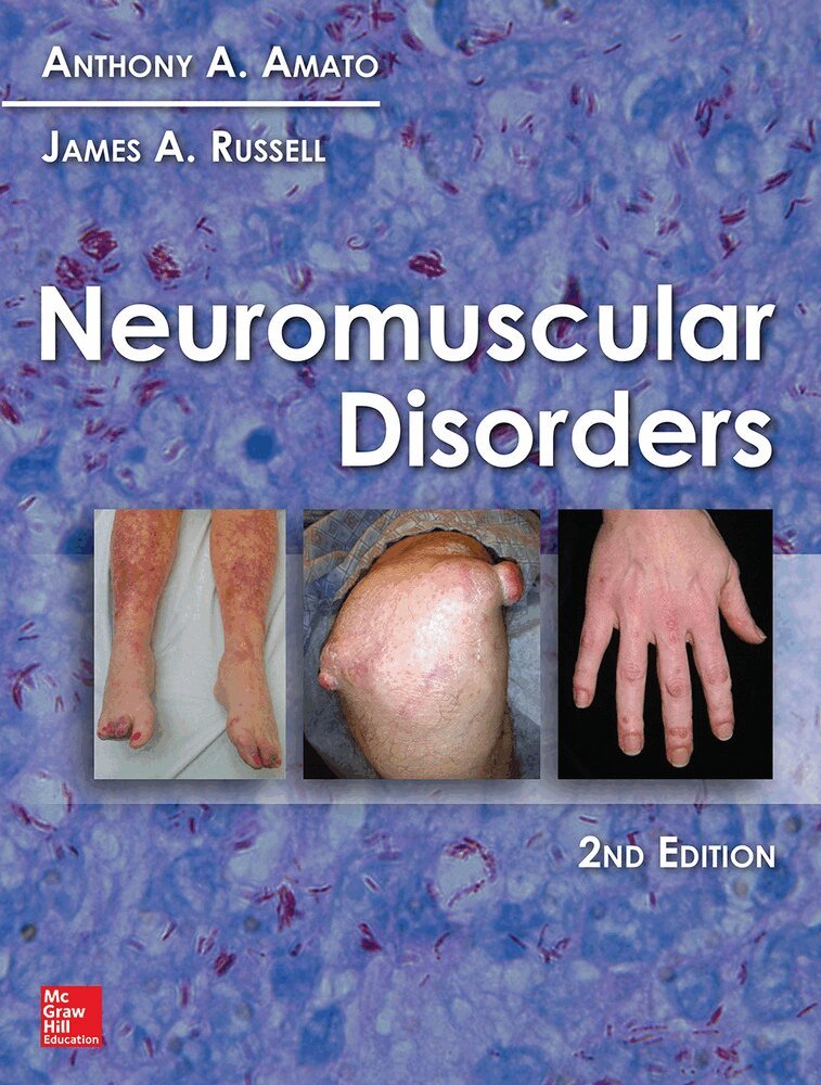 Anthony Amato, James Russell - Neuromuscular Disorders, Inbunden