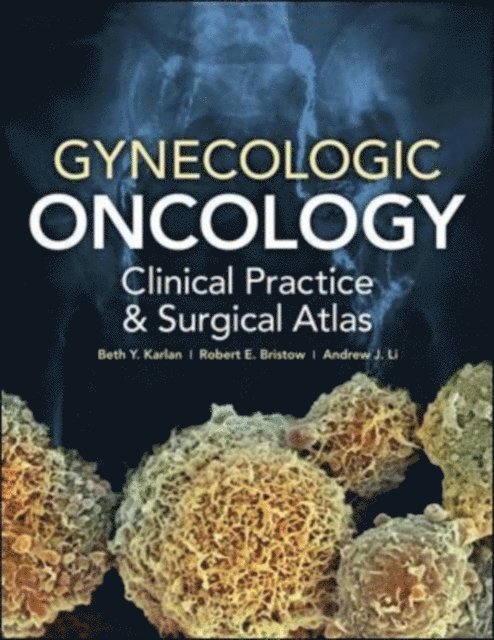 Andrew John Li, Robert E. Bristow, Beth Y. Karlan - Gynecologic Oncology: Clinical Practice and Surgical Atlas, E-bok
