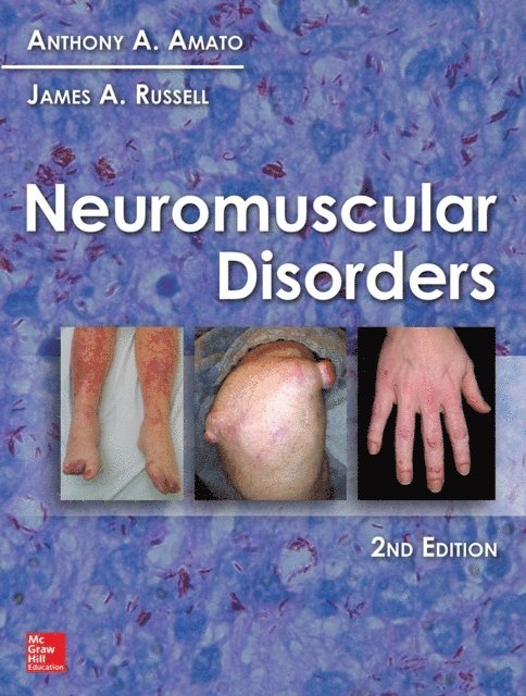 James A. Russell, Anthony A. Amato - Neuromuscular Disorders, 2nd Edition, E-bok