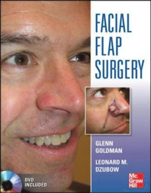 Christopher Yelverton, Leonard Dzubow, Glenn Goldman - Facial Flaps Surgery, E-bok