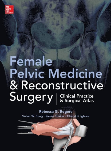 Ranee Thakar, Cheryl B. Iglesia, Vivian Sung, Rebecca G. Rogers - Female Pelvic Medicine and Reconstructive Surgery, E-bok