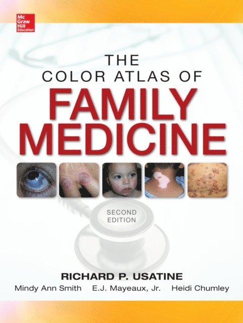 Heidi Chumley, E. J. Mayeaux, Mindy Ann Smith, Richard P. Usatine - Color Atlas of Family Medicine 2/E, E-bok