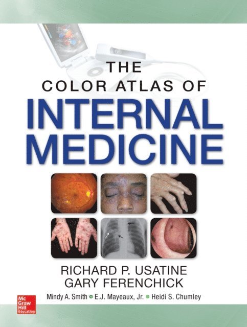 Heidi Chumley, E. J. Mayeux, Mindy Ann Smith, Gary Ferenchick, Richard P. Usatine - Color Atlas of Internal Medicine, E-bok