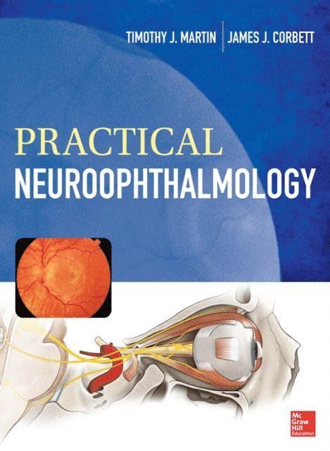 James Corbett, Timothy J. Martin - Practical Neuroophthalmology, E-bok