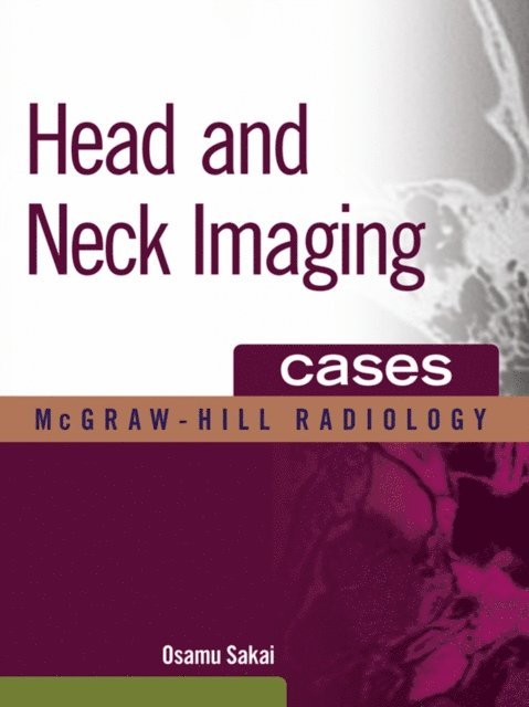 Osamu Sakai - Head and Neck Imaging Cases, E-bok