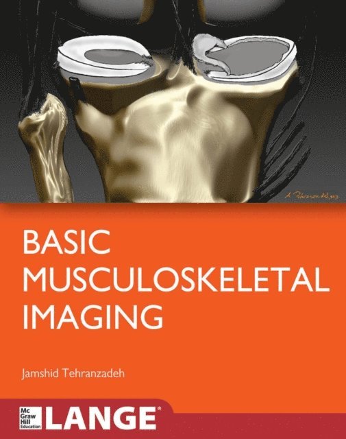 Jamshid Tehranzadeh - Basic Musculoskeletal Imaging, E-bok