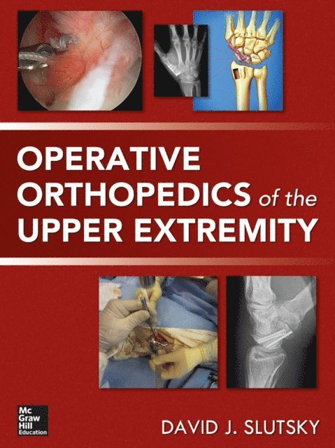 David Slutsky - Operative Orthopedics of the Upper Extremity, E-bok