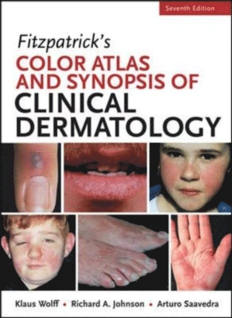 Arturo Saavedra, Richard Allen Johnson, Klaus Wolff - Fitzpatricks Color Atlas and Synopsis of Clinical Dermatology, Seventh Edition, E-bok
