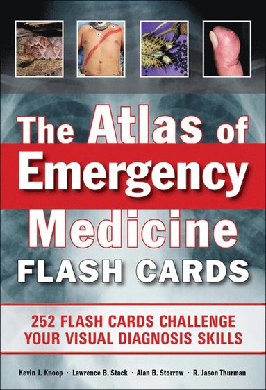 Atlas of Emergency Medicine Flashcards av Kevin Knoop, Lawrence Stack, Alan Storrow, R Jason Thurman, Kevin J Knoop