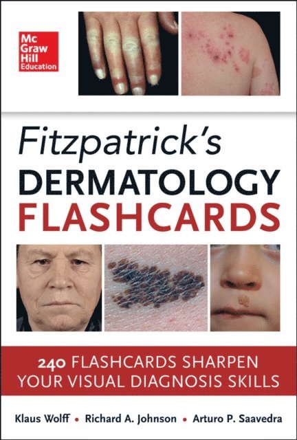 Arturo Saavedra, Richard Allen Johnson, Klaus Wolff - Fitzpatricks Dermatology Flash Cards, E-bok