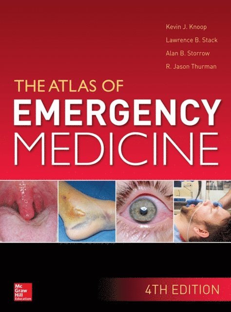 R. Jason Thurman, Alan B. Storrow, Lawrence B. Stack, Kevin J. Knoop - Atlas of Emergency Medicine, 4th Edition, E-bok