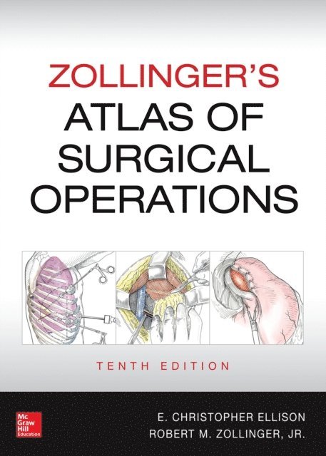 E. Christopher Ellison, Robert M. Zollinger - Zollinger's Atlas of Surgical Operations, 10th edition, E-bok