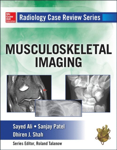 Dhiren Shah, Sanjay Patel, Sayed Ali - Radiology Case Review Series: MSK Imaging, E-bok. Tillgänglighet: Lägg i varukorg