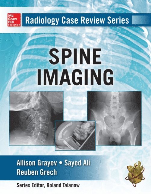 Reuben Gretch, Sayed Ali, Allison Michele Grayev - Radiology Case Review Series: Spine, E-bok. Tillgänglighet: Lägg i varukorg