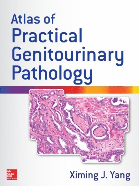 Ximing James Yang - Atlas of Practical Genitourinary Pathology, E-bok