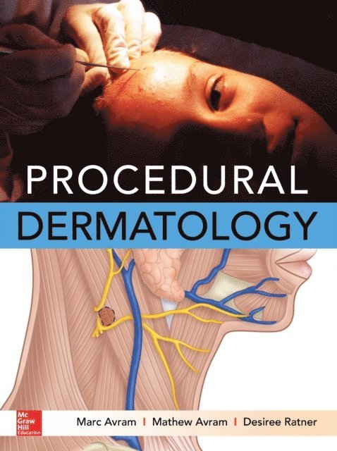 Desiree Ratner, Mathew Avram, Marc Avram - Procedural Dermatology, E-bok