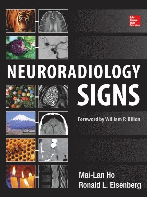 Ronald L. Eisenberg, Mai-Lan Ho - Neuroradiology Signs, E-bok