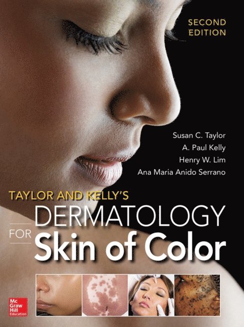 Ana Maria Anido Serrano, Henry Lim, A. Paul Kelly, Susan C. Taylor - Taylor and Kelly's Dermatology for Skin of Color 2/E, E-bok