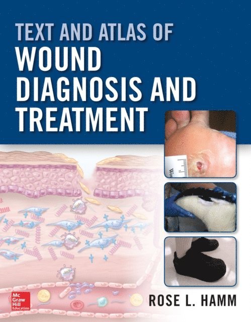 Rose Hamm - Text and Atlas of Wound Diagnosis and Treatment, E-bok. Tillgänglighet: Lägg i varukorg