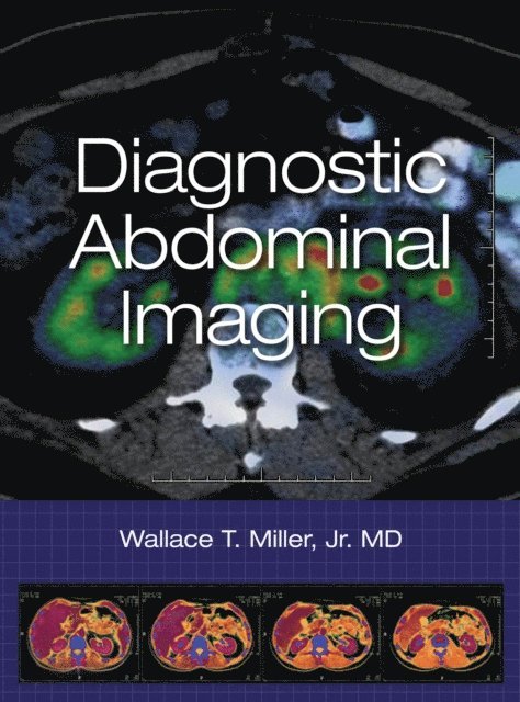 Wallace T. Miller - Diagnostic Abdominal Imaging, E-bok