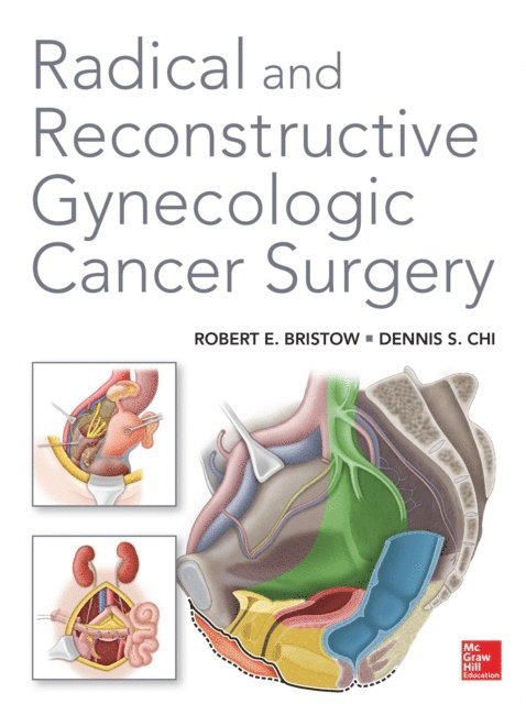 Dennis Chi, Robert E. Bristow - Radical and Reconstructive Gynecologic Cancer Surgery, E-bok
