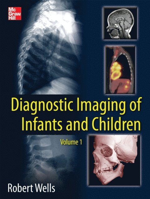 Robert G. Wells - Diagnostic Imaging of Infants and Children, E-bok