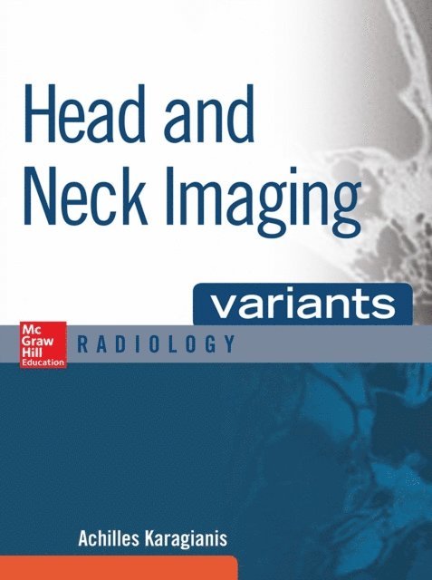 Head and Neck Imaging Variants