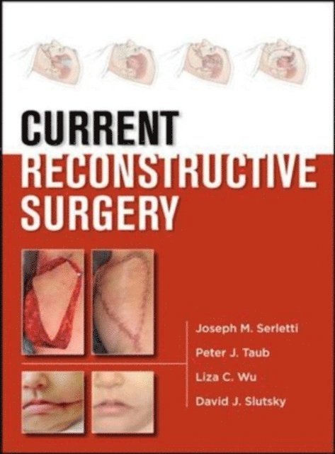 David Slutsky, Liza Wu, Peter J. Taub, Joseph M. Serletti - Current Reconstructive Surgery, E-bok