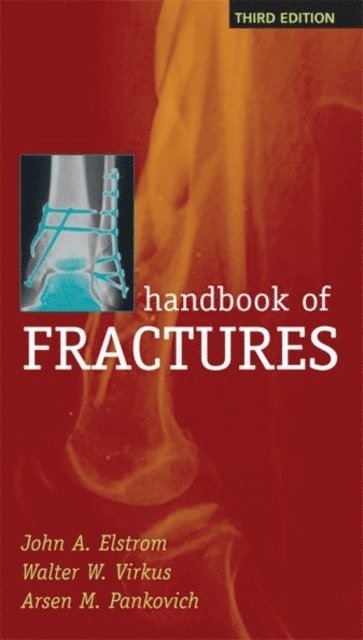 Arsen M. Pankovich, Walter Virkus, John A. Elstrom - Handbook of Fractures, Third Edition, E-bok