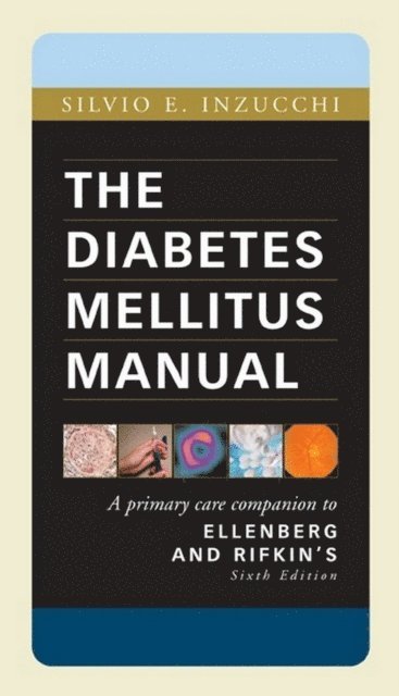 Sylvio Inzucchi - Diabetes Mellitus Manual, E-bok