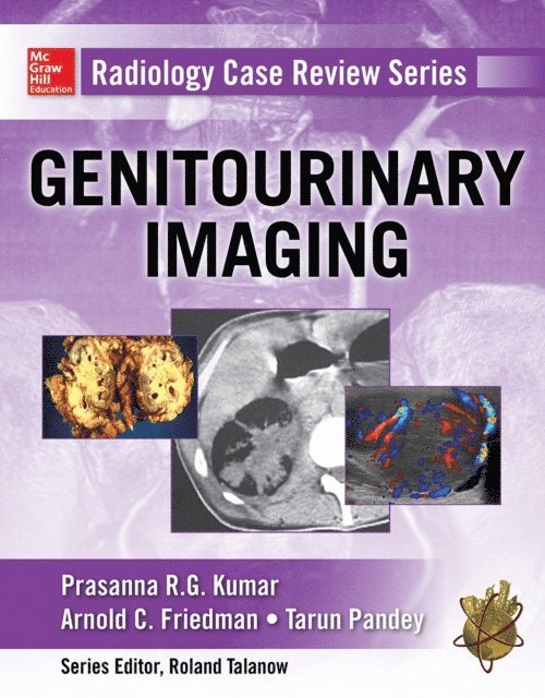 Tarun Pandey, Arnold C. Friedman, Prasanna R. G. Kumar - Radiology Case Review Series: Genitourinary Imaging, E-bok