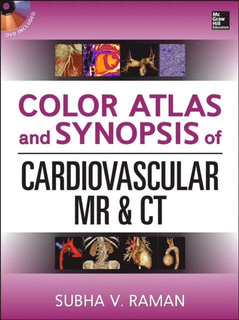 Subha V. Raman - Color Atlas and Synopsis of Cardiovascular MR and CT (SET 2), E-bok