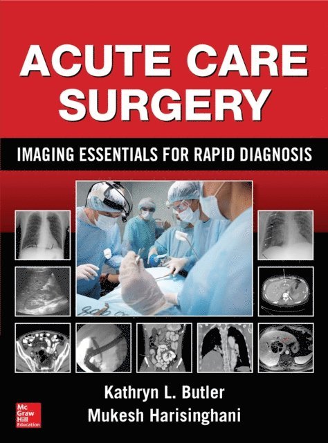 Mukesh Harisinghani, Kathryn L. Butler - Acute Care Surgery: Imaging Essentials for Rapid Diagnosis, E-bok