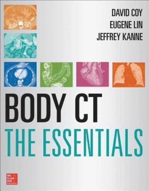 Jeffrey Kanne, David Coy, Eugene Lin - Body CT The Essentials, E-bok