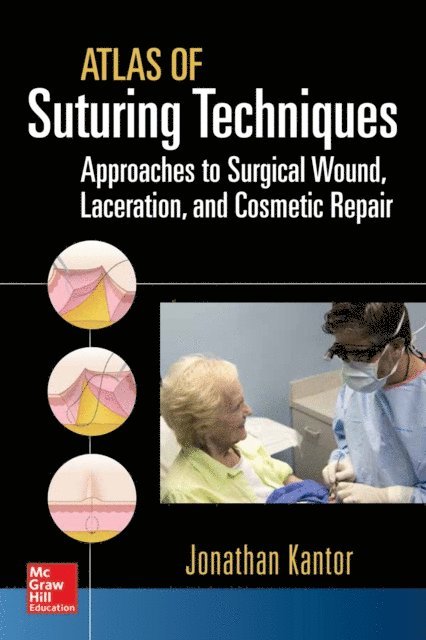 Jonathan Kantor - Atlas of Suturing Techniques: Approaches to Surgical Wound, Laceration, and Cosmetic Repair, E-bok