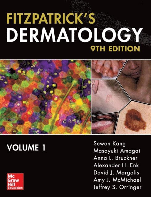 Sewon Kang - Fitzpatrick's Dermatology, Ninth Edition, 2-Volume Set (EBOOK), E-bok