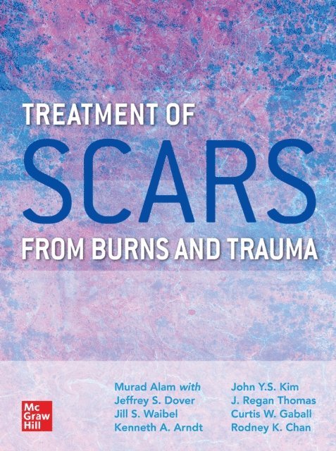 Rodney Chan, John Kim, Matthias Donelan, Jeffrey Dover, Kenneth A. Arndt, Nathan Uebelhoer, Jill Waibel, Murad Alam - Treatment of Scars from Burns and Trauma, E-bok