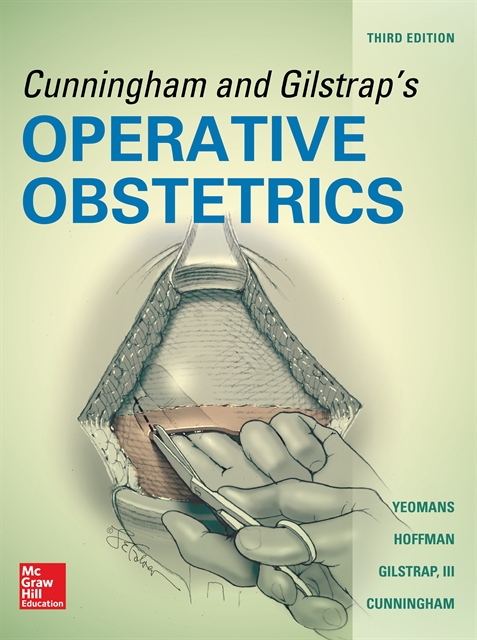 F. Gary Cunningham, Larry C. Gilstrap, Barbara L. Hoffman, Edward R. Yeomans - Cunningham and Gilstrap's Operative Obstetrics, Third Edition, E-bok
