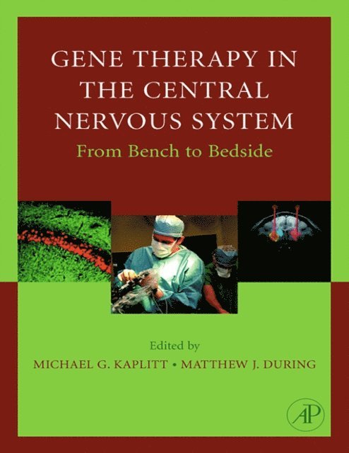 Matthew During, Michael G. Kaplitt - Gene Therapy of the Central Nervous System: From Bench to Bedside, E-bok