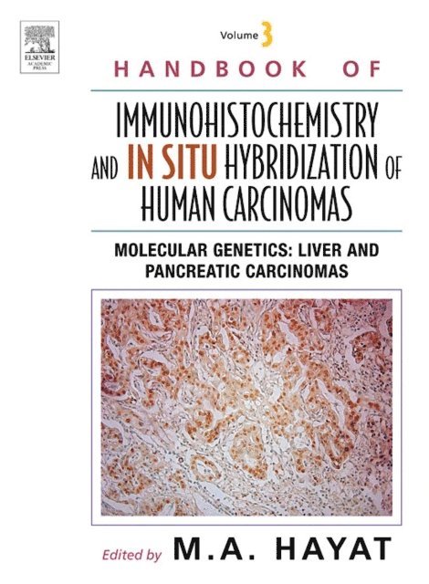 M. A. Hayat - Handbook of Immunohistochemistry and in situ Hybridization of Human Carcinomas, E-bok