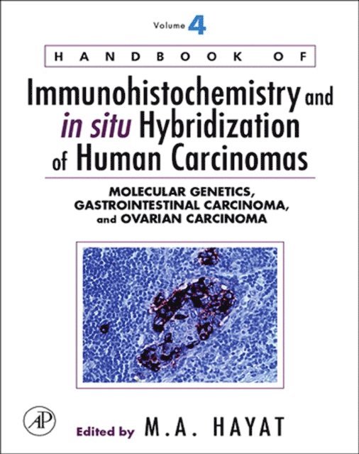M. A. Hayat - Handbook of Immunohistochemistry and in situ Hybridization of Human Carcinomas, E-bok