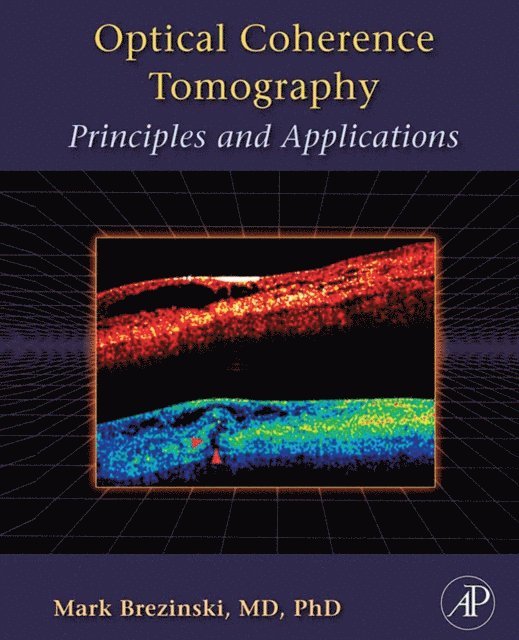 Mark E. Brezinski - Optical Coherence Tomography, E-bok
