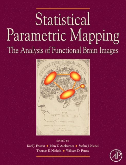 Thomas E. Nichols, Stefan J. Kiebel, John T. Ashburner, Karl J. Friston, William D. Penny - Statistical Parametric Mapping: The Analysis of Functional Brain Images, E-bok