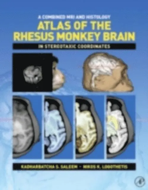 Combined MRI and Histology Atlas of the Rhesus Monkey Brain in Stereotaxic Coordinates
