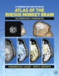Combined MRI and Histology Atlas of the Rhesus Monkey Brain in Stereotaxic Coordinates