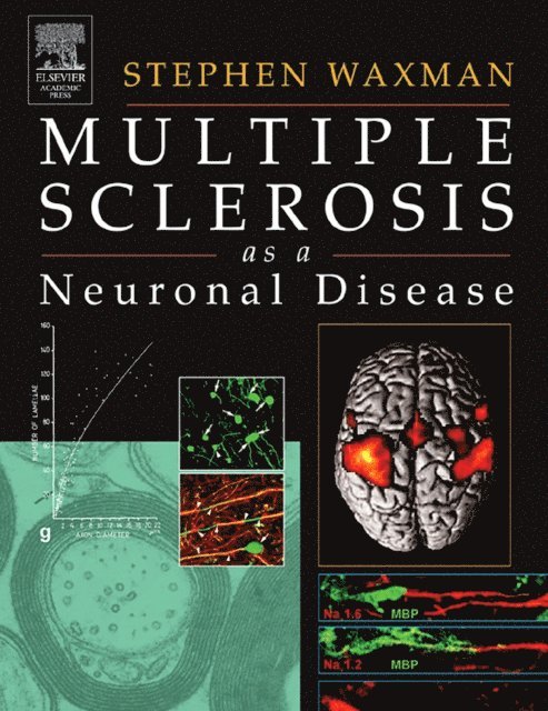 Stephen Waxman - Multiple Sclerosis As A Neuronal Disease, E-bok. Tillgänglighet: Lägg i varukorg
