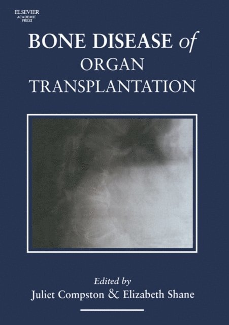 Elizabeth Shane, Juliet Compston - Bone Disease of Organ Transplantation, E-bok