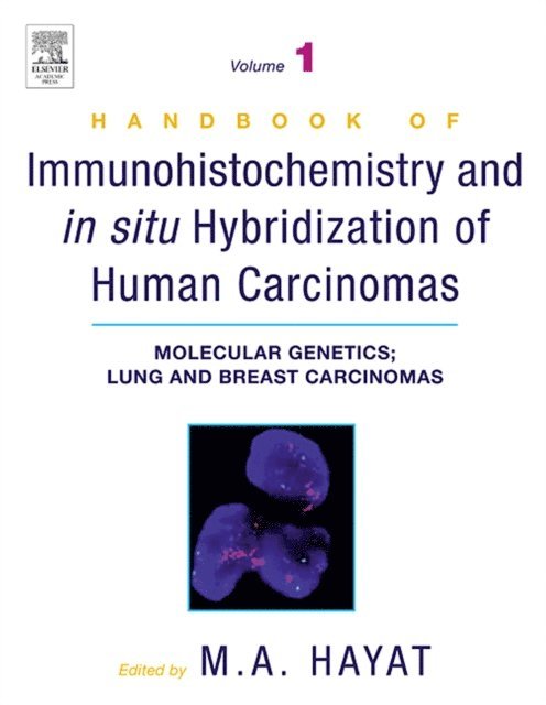 M. A. Hayat - Handbook of Immunohistochemistry and in Situ Hybridization of Human Carcinomas, E-bok